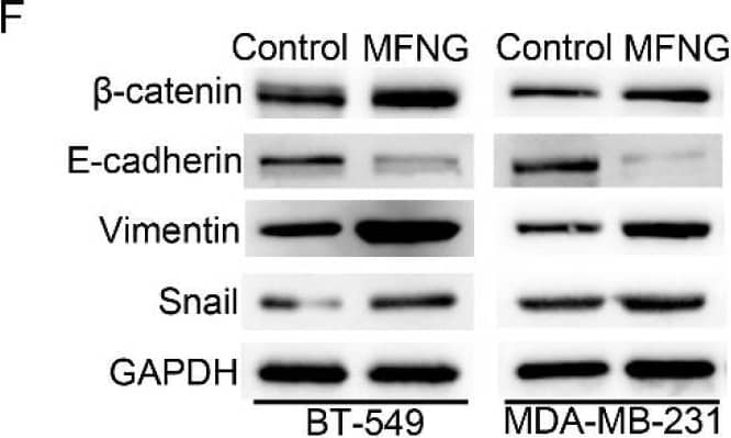 MFNG expression enhanced the cell growth and migration of TNBC cells. MFNG overexpression and knockdown were detected by RT-qPCR (A) and Western blot (B) in TNBC cells, SCR was short for Scramble and GAPDH served as an internal control. (C,D) The effect of MFNG on cell growth was examined in TNBC cells by colony formation and CCK8 assays. (E) The cell migration was assessed by transwell in MFNG-overexpressing or knockdown TNBC cells. (F) Western blot analysis of epithelial–mesenchymal transition (EMT) and growth-related genes in TNBC cells overexpressing MFNG, GAPDH was loaded as an internal control. (G) RT-qPCR analyzed the expression of Notch target genes HES1 and HEY1 in TNBC cells overexpressing MFNG, GAPDH served as an internal control. Data were analyzed using a Student’s t-test. All * p < 0.05, ** p < 0.01, *** p < 0.001. Image collected and cropped by CiteAb from the following open publication (//pubmed.ncbi.nlm.nih.gov/35804829), licensed under a CC-BY license. Not internally tested by Novus Biologicals.