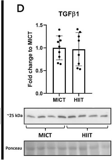 Effects of MICT and HIIT on the liver. (A) Representative histological images stained with Picro Sirius Red at 10× and 20× for (A) MICT group and (B) HIIT group. Arrows indicate collagen accumulation points. (C) Collagen 1 and (D) transforming growth factor (TGF)  beta 1 and their representative blots below its respective graph with its membrane stained with Ponceau S used as loading control. Data are presented as mean +/- SD. *: p < 0.05. Each dot represents a participant. Image collected and cropped by CiteAb from the following open publication (//www.mdpi.com/2077-0383/13/11/3273), licensed under a CC-BY license. Not internally tested by Novus Biologicals.