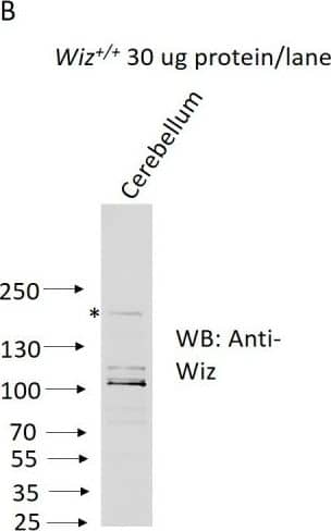 Anti-Wiz antibody western blotting.(A) Western blotting for Wiz using an NBP180586 anti-Wiz antibody is shown for total protein lysates from E12.5 Wiz+/+ and WizMommeD30/MommeD30 embryo head. Three bands at ~100 kD represent Wiz isoforms, consistent with UCSC gene splice variants, in Wiz+/+ sample and are absent in WizMommeD30/ MommeD30 sample. Western blotting with an anti-gamma -Tubulin antibody is shown as a loading control. (B) Anti-Wiz antibody staining in adult cerebellum, showing the short (~100–120 KDa) isoforms present in embryo head protein extract, as well as a long (~160 KDa) isoform previously reported to be expressed (Matsumoto et al., 1998).DOI://dx.doi.org/10.7554/eLife.15082.005 Image collected and cropped by CiteAb from the following open publication (//pubmed.ncbi.nlm.nih.gov/27410475), licensed under a CC-BY license. Not internally tested by Novus Biologicals.