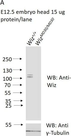 Anti-Wiz antibody western blotting.(A) Western blotting for Wiz using an NBP180586 anti-Wiz antibody is shown for total protein lysates from E12.5 Wiz+/+ and WizMommeD30/MommeD30 embryo head. Three bands at ~100 kD represent Wiz isoforms, consistent with UCSC gene splice variants, in Wiz+/+ sample and are absent in WizMommeD30/ MommeD30 sample. Western blotting with an anti-gamma -Tubulin antibody is shown as a loading control. (B) Anti-Wiz antibody staining in adult cerebellum, showing the short (~100–120 KDa) isoforms present in embryo head protein extract, as well as a long (~160 KDa) isoform previously reported to be expressed (Matsumoto et al., 1998).DOI://dx.doi.org/10.7554/eLife.15082.005 Image collected and cropped by CiteAb from the following open publication (//pubmed.ncbi.nlm.nih.gov/27410475), licensed under a CC-BY license. Not internally tested by Novus Biologicals.