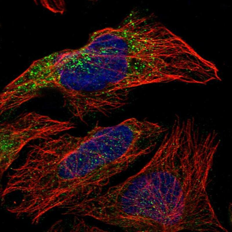 Staining of human cell line U-2 OS shows localization to cytosol.
