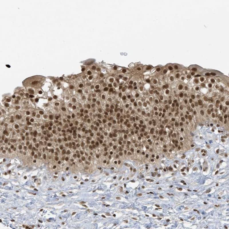 Staining of human urinary bladder shows moderate nuclear positivity in urothelial cells.