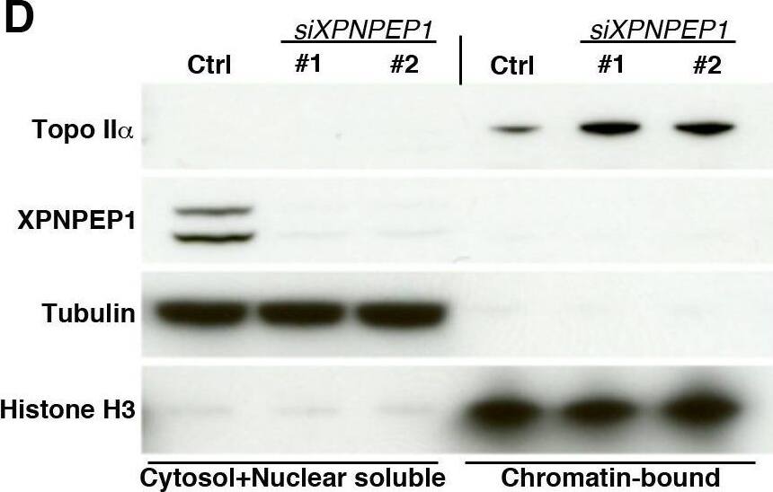 Knockdown of human XPNPEP1 causes accumulation of DNA damage.(A) Western blot analysis on total protein extracts showing efficient knock down of XPNPEP1 by two independent siRNAs that also induce accumulation of Topoisomerase II alpha . (Β) Pulse field gel stained with ethidium bromide in control cells and following knock down of XPNPEP1. Note increased intensity of band labelled as “a