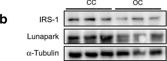 Maternal obesity compromises glucose and ER homeostasis concomitantly through miR-126-3p programming in eWAT of adult offspring. (a) Normalised relative miR-126-3p, Irs1 and Lnpk expression (n = 5 per group). (b) Representative blots followed by normalised (c) IRS-1 and (d) Lunapark protein expression, n = 6 for both. (e) Altered relative expression of ER-related genes, n = 5–6 per group. (f) Percentage of starting glucose during glucose tolerance test, n = 6–7 per group. Data in (a, c–e) were analysed by unpaired Student’s t test (CC vs OC offspring). Data in (f) were analysed by two-way (repeated measures) ANOVA followed by Bonferroni’s multiple comparisons test; *p < 0.05, **p < 0.01 and ***p < 0.001. All the graphs represent mean +/- SEM Image collected and cropped by CiteAb from the following open publication (//pubmed.ncbi.nlm.nih.gov/33501603), licensed under a CC-BY license. Not internally tested by Novus Biologicals.