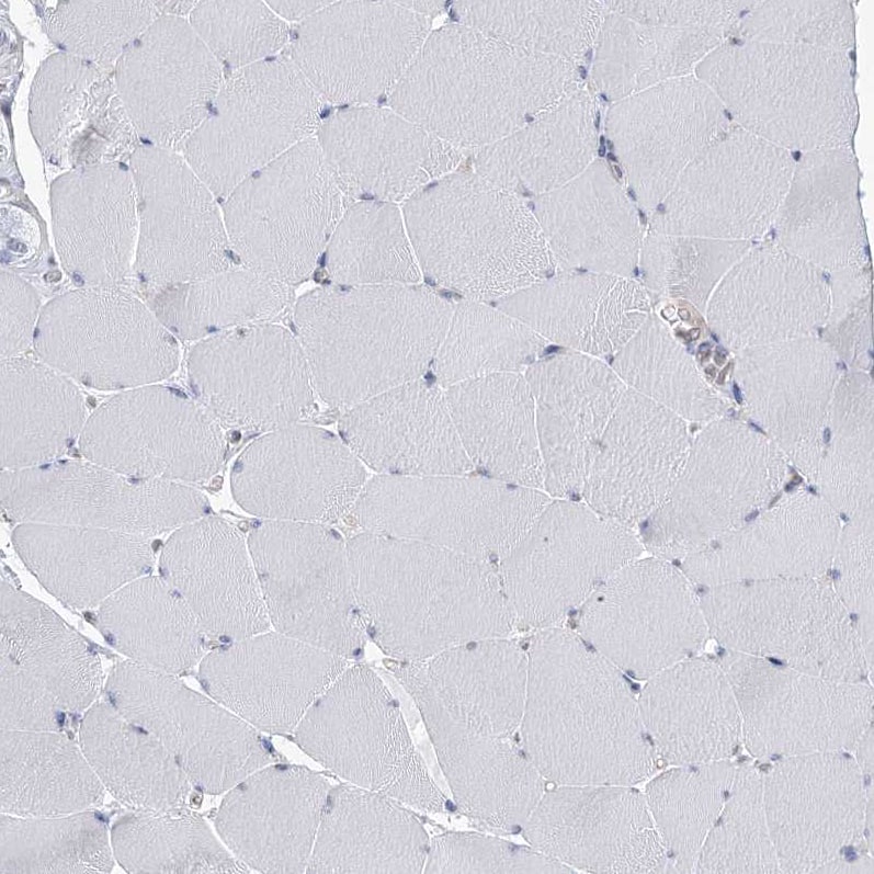 Staining of human skeletal muscle shows no positivity in myocytes as expected.