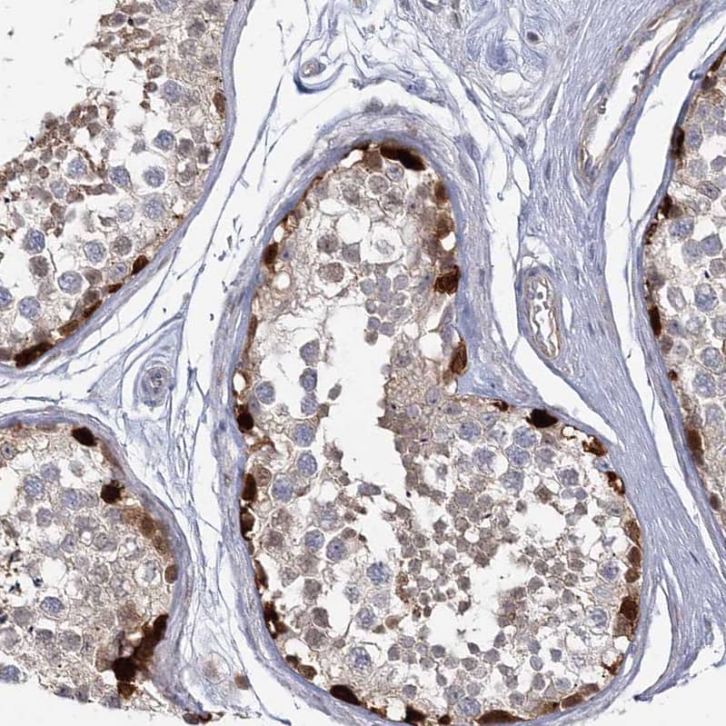 Staining of human testis shows strong nuclear positivity in a subset of cells in seminiferous ducts.
