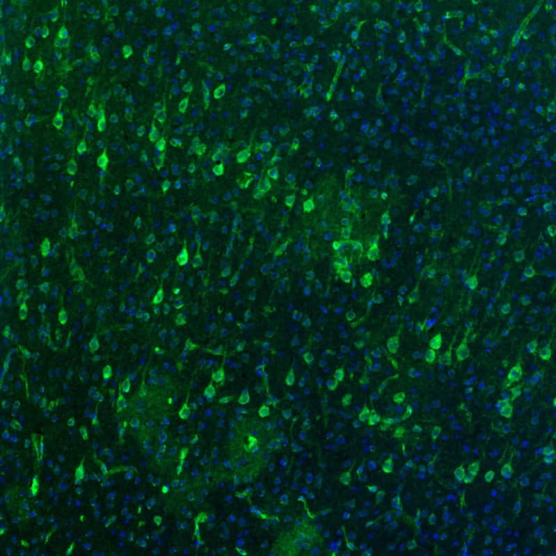 Staining of mouse brain shows moderate to strong positivity in neurons in the cerebral cortex.