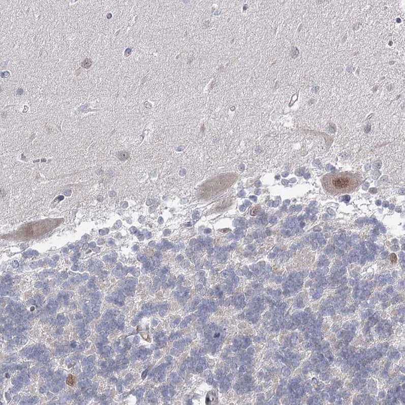 Staining of human cerebellum shows moderate nuclear positivity in Purkinje cells.