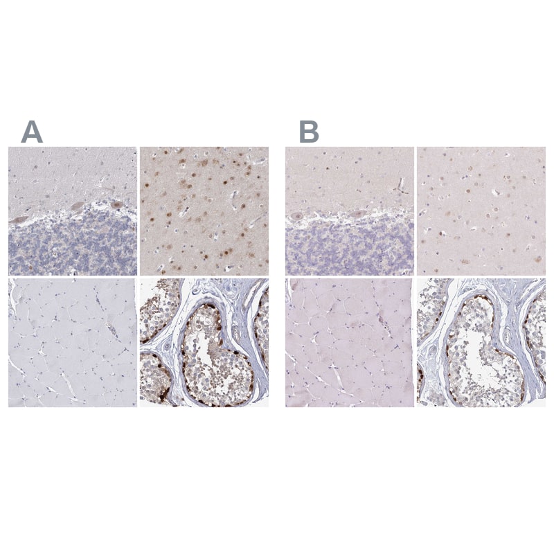 <b>Orthogonal Strategies Validation. </b>Staining of human cerebellum, cerebral cortex, skeletal muscle and testis HPA037536 (A) shows similar protein distribution across tissues to independent antibody HPA003103 (B).
