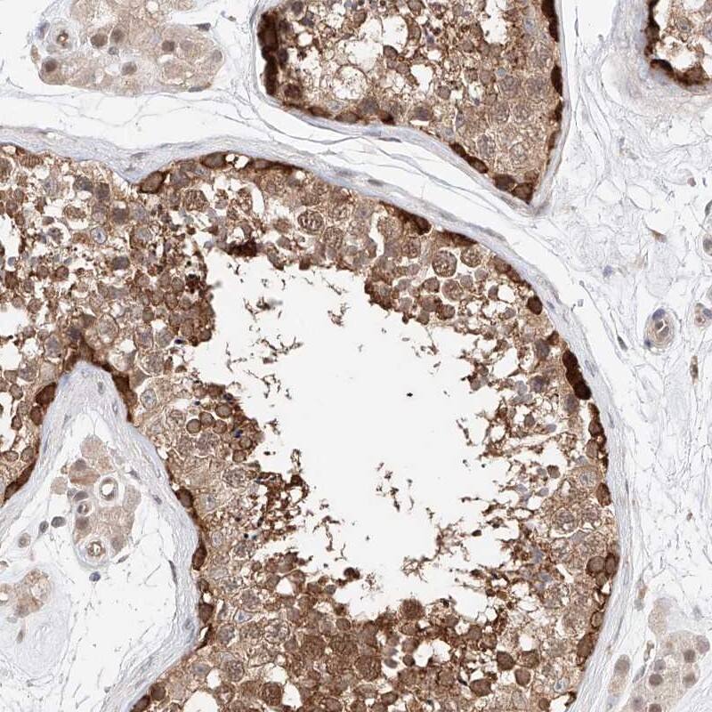 Staining of human testis shows strong cytoplasmic positivity in seminiferus duct cells.
