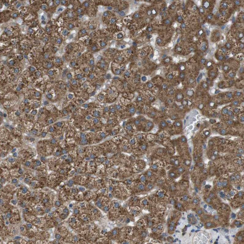 Immunohistochemistry-Paraffin SSR3 Antibody - BSA Free