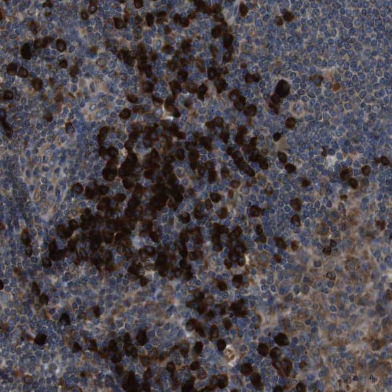 Staining of human lymph node shows strong cytoplasmic positivity in non-germinal center cells.