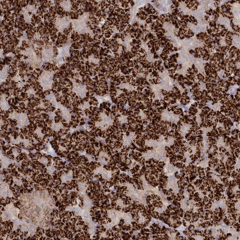 Immunohistochemistry-Paraffin TGFBRAP1 Antibody - BSA Free