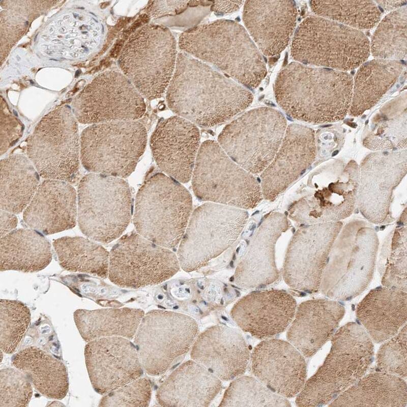 Staining of human skeletal muscle shows moderate cytoplasmic positivity in myocytes.