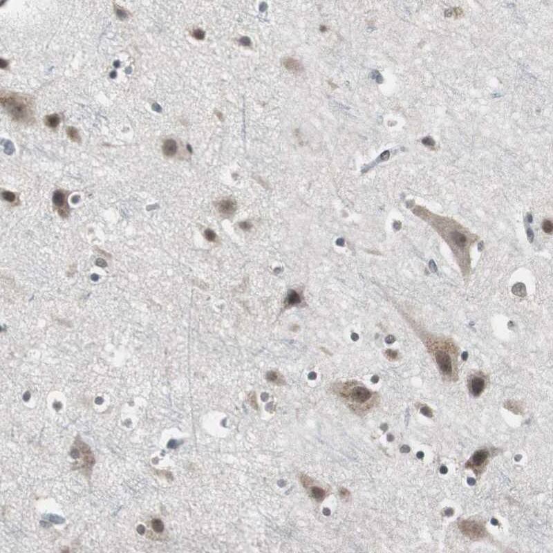 Staining of human cerebral cortex shows moderate nuclear and cytoplasmic positivity in neuronal cells.