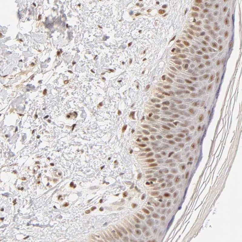 Staining of human skin shows moderate nuclear positivity in squamous epithelial cells with additional weak cytoplasmic positivity.