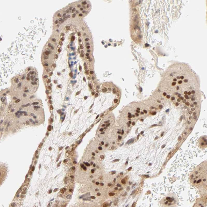 Staining of human placenta shows moderate nuclear/cytoplasmic positivity in trophoblastic cells.