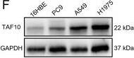 TAF10 plays oncogenic role in LUAD. A mRNA expression levels of the corresponding gene in human normal bronchial epithelial cells (16HBE) and LUAD cell lines. B TAF10 mRNA expression levels in various tumors and matched normal tissues from the TCGA and GTEx databases, analyzed using SangerBox platform. C The stemness features (RNA expression-based stemness scores) analyses of TAF10 across different types of tumors in the TCGA database, analyzed by SangerBox platform. (D-E) Disease-free survival (D) and overall survival (E) analyses of TAF10 in LUAD samples from the TCGA database, performed using the GEPIA2 platform. (F) Protein expression levels of TAF10 in 16HBE and LUAD cell lines. G Representative IHC analysis of TAF10 expression in paired adjacent and tumorous tissues from LUAD patients (n = 5 pairs, 10 tissues in total). Black scale bar: 50 μm; red scale bar: 20 μm. H TAF10 knockdown in LUAD cells was confirmed by Western blot analysis. I LUAD cell lines were stably transfected with either shCtl or shTAF10 for 24, 48, and 72 h, and cell viability was measured using a CCK-8 assay. (J) The effect of TAF10 knockdown on colony formation in LUAD cells was assessed using a colony formation assay. (K) Representative micrographs and quantification of tumor sphere formation by TAF10-silenced cells (shTAF10) or vector control cells (shCtl). Scale bar, 100 μm. L–N GSEA plot of KEGG (L), GOBP (M), and Hallmark pathways (N), grouped by TAF10 expression into TAF10-high and TAF10-low subgroups. NES represents the normalized enrichment score, and FDR represents the adjusted p-value Image collected and cropped by CiteAb from the following open publication (//pubmed.ncbi.nlm.nih.gov/39987127), licensed under a CC-BY license. Not internally tested by Novus Biologicals.