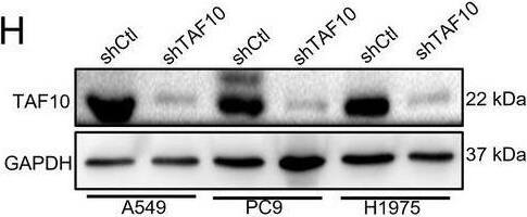 TAF10 plays oncogenic role in LUAD. A mRNA expression levels of the corresponding gene in human normal bronchial epithelial cells (16HBE) and LUAD cell lines. B TAF10 mRNA expression levels in various tumors and matched normal tissues from the TCGA and GTEx databases, analyzed using SangerBox platform. C The stemness features (RNA expression-based stemness scores) analyses of TAF10 across different types of tumors in the TCGA database, analyzed by SangerBox platform. (D-E) Disease-free survival (D) and overall survival (E) analyses of TAF10 in LUAD samples from the TCGA database, performed using the GEPIA2 platform. (F) Protein expression levels of TAF10 in 16HBE and LUAD cell lines. G Representative IHC analysis of TAF10 expression in paired adjacent and tumorous tissues from LUAD patients (n = 5 pairs, 10 tissues in total). Black scale bar: 50 μm; red scale bar: 20 μm. H TAF10 knockdown in LUAD cells was confirmed by Western blot analysis. I LUAD cell lines were stably transfected with either shCtl or shTAF10 for 24, 48, and 72 h, and cell viability was measured using a CCK-8 assay. (J) The effect of TAF10 knockdown on colony formation in LUAD cells was assessed using a colony formation assay. (K) Representative micrographs and quantification of tumor sphere formation by TAF10-silenced cells (shTAF10) or vector control cells (shCtl). Scale bar, 100 μm. L–N GSEA plot of KEGG (L), GOBP (M), and Hallmark pathways (N), grouped by TAF10 expression into TAF10-high and TAF10-low subgroups. NES represents the normalized enrichment score, and FDR represents the adjusted p-value Image collected and cropped by CiteAb from the following open publication (//pubmed.ncbi.nlm.nih.gov/39987127), licensed under a CC-BY license. Not internally tested by Novus Biologicals.