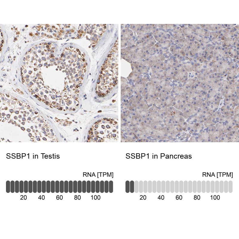 Analysis in human testis and pancreas tissues. Corresponding RNA-seq data are presented for the same tissues.