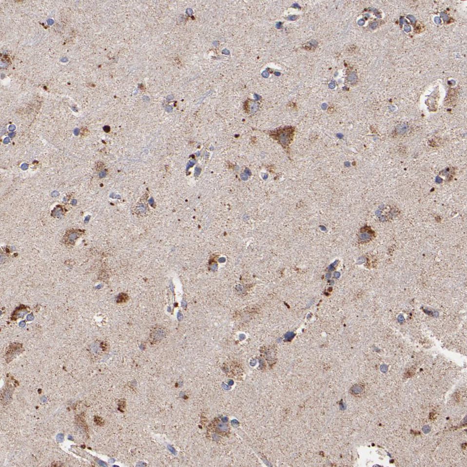 Staining of human cerebral cortex shows granular cytoplasmic positivity in neurons.