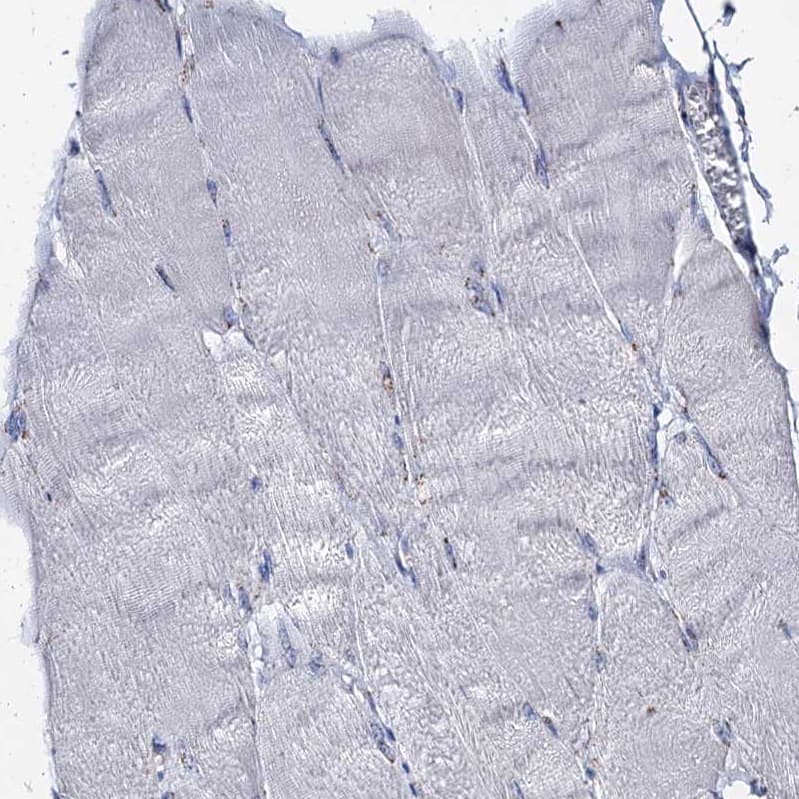 Immunohistochemistry-Paraffin Tm9sf3 Antibody - BSA Free