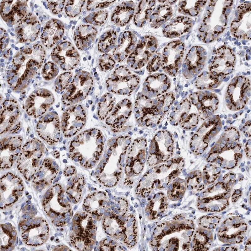 Immunohistochemistry-Paraffin Tm9sf3 Antibody - BSA Free
