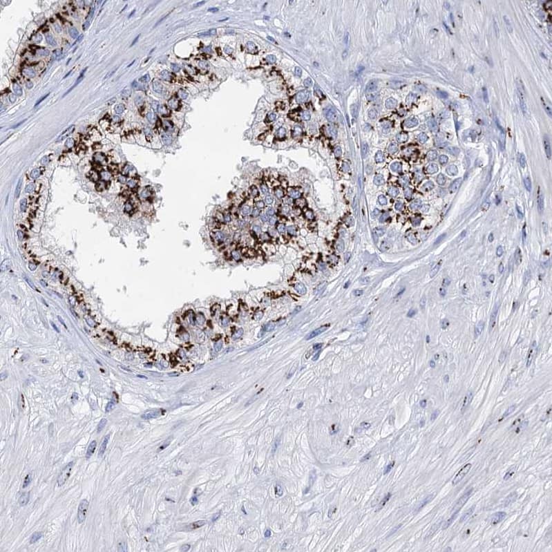 Staining of human prostate shows strong positivity in cytoplasm granular in glandular cells.