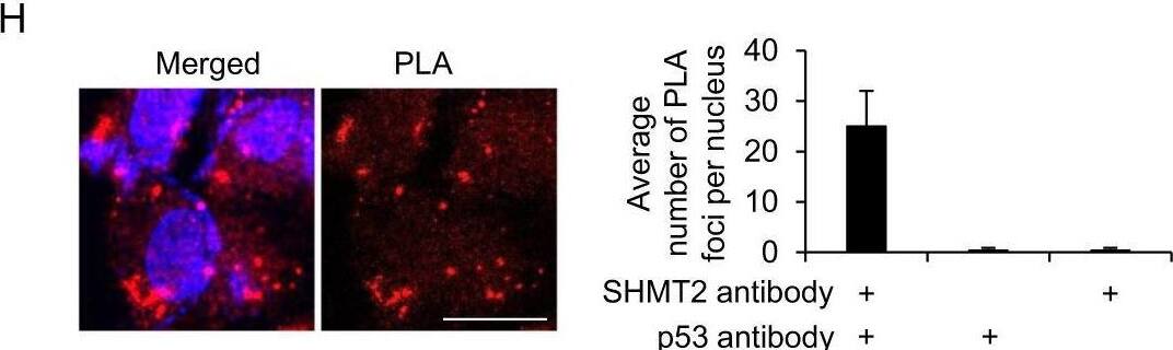 SHMT2 interacts with cytosolic p53.A, B SHMT2 purified by Flag-IP was collected after in-gel digestion and used for LC-MS/MS analysis to search for the binding proteins of SHMT2. A Flag-SHMT2 was transfected into 293 T cells for 24 h, isolated by coimmunoprecipitation, separated by SDS-PAGE and stained using Coomassie. B Tabular display of the number of tryptic peptides from each of the indicated proteins that coprecipitated with SHMT2. C HCT116 cells transfected with Flag-SHMT2 were immunoprecipitated with FLAG-M2 beads. Western blotting for p53 and SHMT2 was then performed. Immunoprecipitation using an anti-p53 antibody (Do-1) was followed by western blotting with anti-SHMT2 or anti-p53 antibodies (ab32389, Abcam). D SHMT2 interacted mainly with endogenous cytosolic p53 in HCT116 cells. Cyt cytosolic, Nuc nuclear. E Cytosolic p53 bound to SHMT2. HCT116 cells transfected with Flag-WT, nuclear (NES-) or cytosolic p53 (NLS-) were immunoprecipitated with FLAG-M2 beads. Western blotting for FLAG and SHMT2 was then performed. F–H Colocalization of SHMT2 and cytosolic p53. A set of partially enlarged pictures are attached on the right side. F Representative micrographs of HCT116 cells transfected with plasmids expressing WT, nuclear (NES-) and cytosolic p53 (NLS-). G Representative micrographs of HCT116 cells stained for SHMT2 and p53. H Representative micrographs of HCT116 cells in the proximity ligation assay (PLA). Scale bar, 10 μm. PLA foci per nucleus for the two antibodies are presented in the histogram. Image collected and cropped by CiteAb from the following open publication (//pubmed.ncbi.nlm.nih.gov/33990700), licensed under a CC-BY license. Not internally tested by Novus Biologicals.