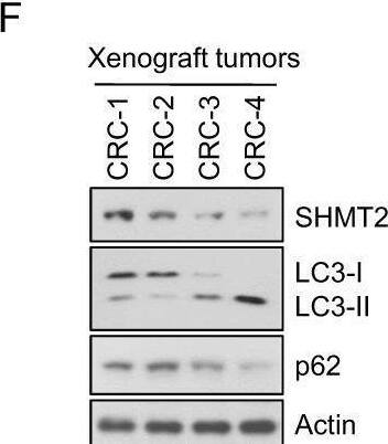 CQ sensitizes PDXs with low SHMT2 expression to 5-FU treatment.A Images of immunohistochemical staining for SHMT2, LC3, and p62 in CRC tissues from four selected patients (two with low SHMT2 expression and two with high SHMT2 expression) using the indicated antibodies. Scale bar, 50 μm. B Schematic of PDX model establishment. C–E Xenograft experiments with 5-FU or CQ treatment are described in the Methods section. C Xenograft tumors were harvested and photographed. D, E Quantification of the average volumes (D) and weights (E) of the xenograft tumors are shown. Four tumors from individual mice were included in each group; *P < 0.05, **P < 0.01. F Representative western blot of xenograft tumors. G Schematic diagram showing the basic hypothesis/conclusion/model. Image collected and cropped by CiteAb from the following open publication (//pubmed.ncbi.nlm.nih.gov/33990700), licensed under a CC-BY license. Not internally tested by Novus Biologicals.
