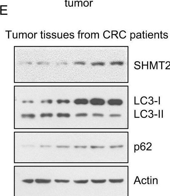 5-FU resistance is related to low SHMT2 expression and autophagy in CRC.A Expression of SHMT2 in three GEO datasets (GSE39582, GSE24551, and GSE21510). ***P < 0.001. B Representative images of immunohistochemical staining for SHMT2 in peritumor and CRC tissues. Scale bar, 50 μm. C 378 stage II–III paired CRC tissues assessed by immunohistochemistry are shown. **P < 0.01. D Survival of patients stratified by the SHMT2 expression level. DFS and OS of patients with stage II–III disease treated with 5-FU-based chemotherapy stratified by the SHMT2 expression level. E, F The protein levels of endogenous SHMT2, p62, LC3, and  beta -actin (as the internal standard) were examined by western blotting in CRC tissues. F The Spearman rank correlation test was used to evaluate correlations between the SHMT2, p62, and LC3 expression status in CRC tissues as determined by western blotting. G Representative images of immunohistochemical staining. Scale bar, 50 μm. Image collected and cropped by CiteAb from the following open publication (//pubmed.ncbi.nlm.nih.gov/33990700), licensed under a CC-BY license. Not internally tested by Novus Biologicals.