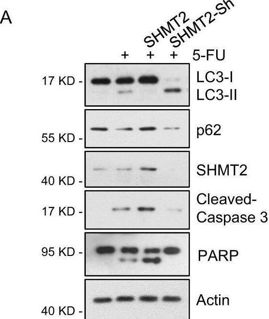Inhibition of autophagy induced by low SHMT2 expression sensitizes CRC cells to 5-FU treatment.A SHMT2 promoted apoptosis and inhibited autophagy in response to 5-FU treatment. Western blot analysis of lysates of HCT116 cells that were transfected with SHMT2 or infected with SHMT2-sh lentivirus and treated with 5-FU (10 μM) for 24 h. The protein levels of SHMT2, p62, LC3, cleaved Caspase 3, PARP, and  beta -actin (as the internal standard) were assessed with the indicated antibodies. B The protein levels of SHMT2, p62, LC3, cleaved Caspase 3, PARP, and  beta -actin (as the internal standard) were assessed in SHMT2-KO HCT116 cells. C The indicated cells were treated with 5-FU (2 μM), 3-MA (10 mM) or chloroquine diphosphate salt (CQ, 20 μM) for 4 days and analyzed using the MTT cell viability assay. *P < 0.05, **P < 0.01. D–F The xenograft experiment with Control and SHMT2-sh cells treated with 5-FU or CQ is described in the Methods section. D Xenograft tumors were harvested and photographed. E, F Quantification of the average volumes (E) and weights (F) of the xenograft tumors are shown. Five tumors from individual mice were included in each group; *P < 0.05, **P < 0.01. Image collected and cropped by CiteAb from the following open publication (//pubmed.ncbi.nlm.nih.gov/33990700), licensed under a CC-BY license. Not internally tested by Novus Biologicals.