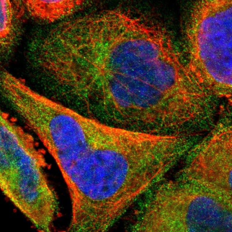 Staining of human cell line A-431 shows localization to cytosol.