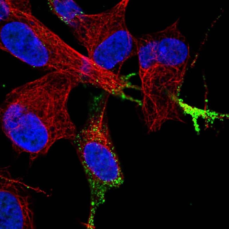 Staining of human cell line SH-SY5Y shows localization to vesicles.