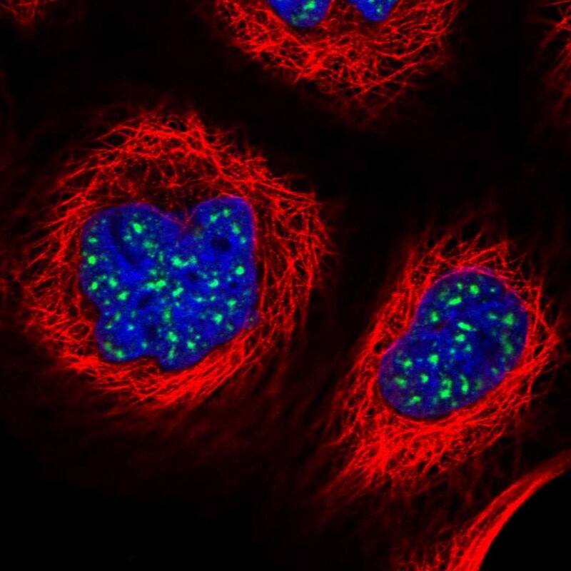 Staining of human cell line A-431 shows localization to nuclear speckles.