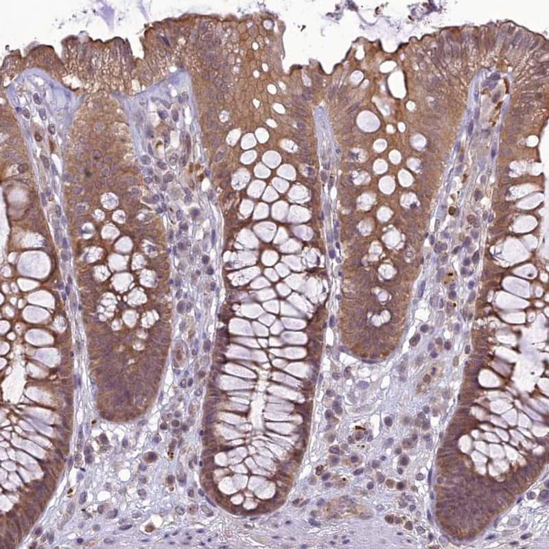 Staining of human colon shows moderate cytoplasmic positivity in glandular cells.