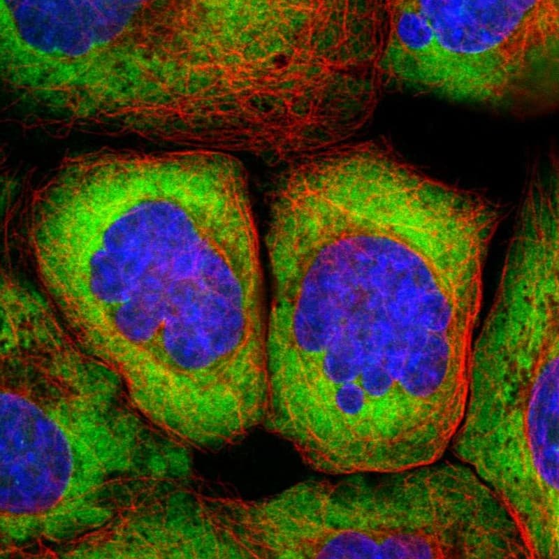 Staining of human cell line A-431 shows localization to cytosol & endoplasmic reticulum.