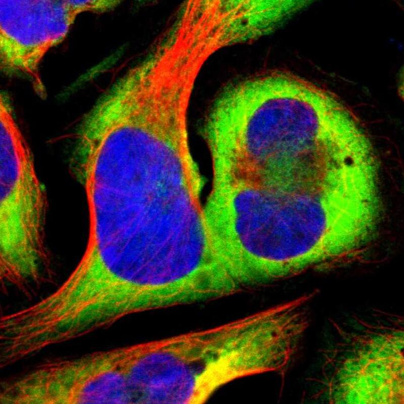 Staining of human cell line U-2 OS shows localization to cytosol & endoplasmic reticulum.