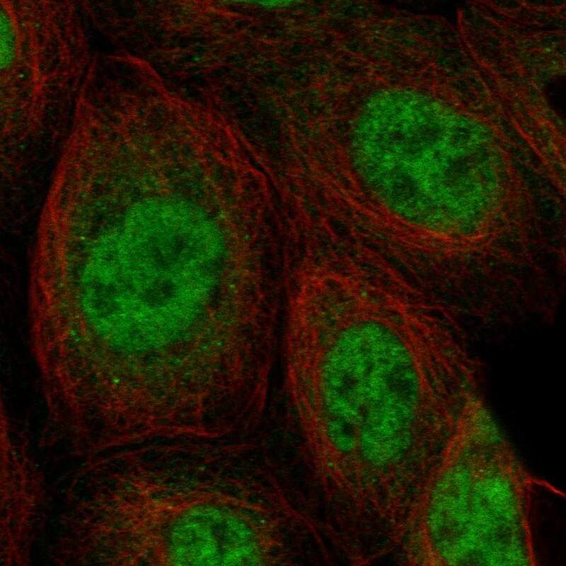 Staining of human cell line A-431 shows localization to nucleoplasm.