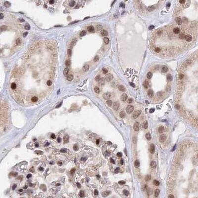 Staining of human kidney.