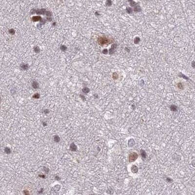 Staining of human cerebral cortex.