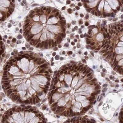 Staining of human colon.