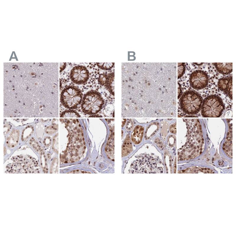 <b>Orthogonal Strategies Validation. </b>Staining of human cerebral cortex, colon, kidney and testis HPA040919 (A) shows similar protein distribution across tissues to independent antibody HPA041826 (B).
