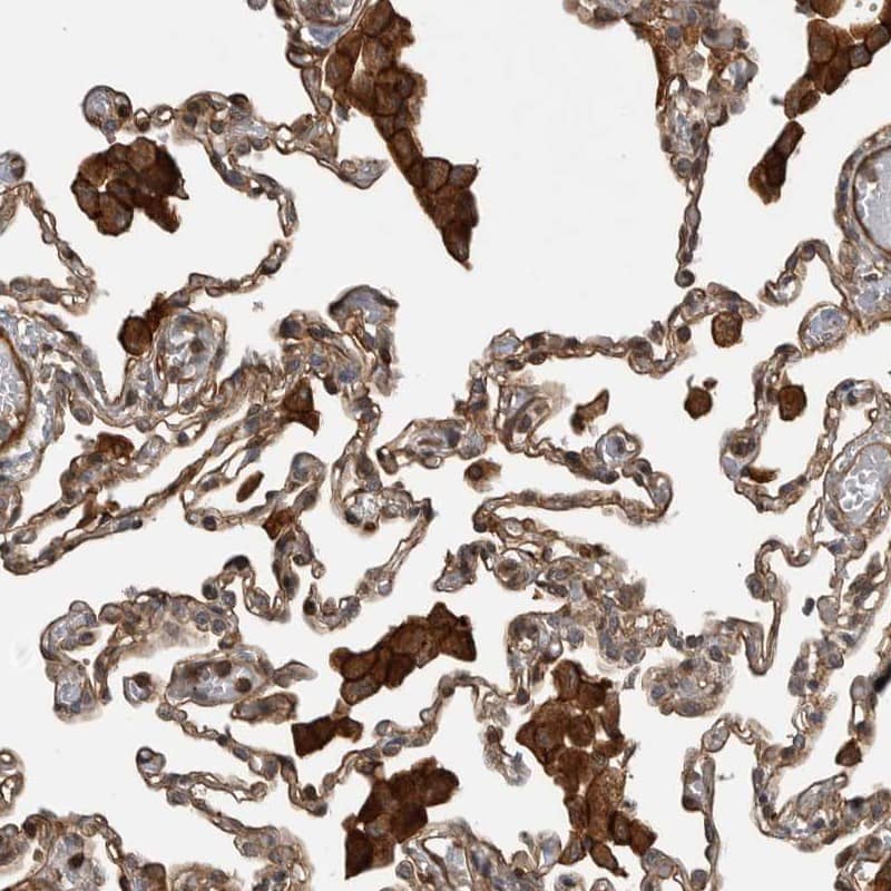 Staining of human lung shows distinct membranous and cytoplasmic positivity in alveolar cells.
