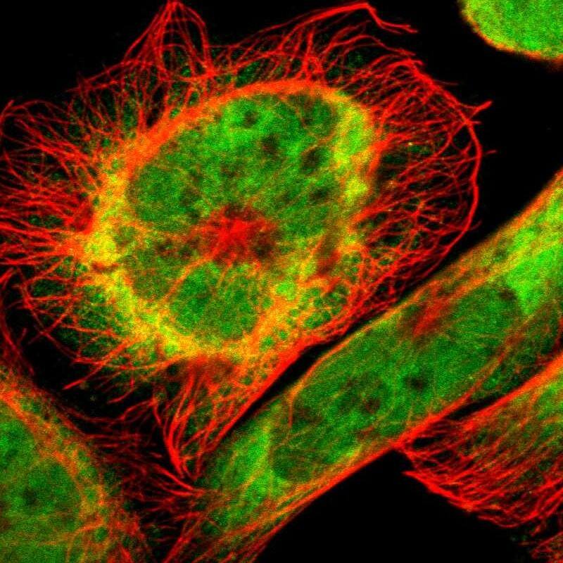 Staining of human cell line A-431 shows localization to nucleoplasm & cytosol.