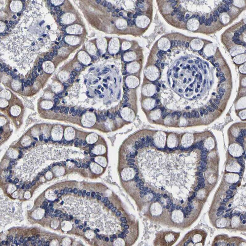 Staining of human small intestine shows weak to moderate cytoplasmic positivity in glandular cells.