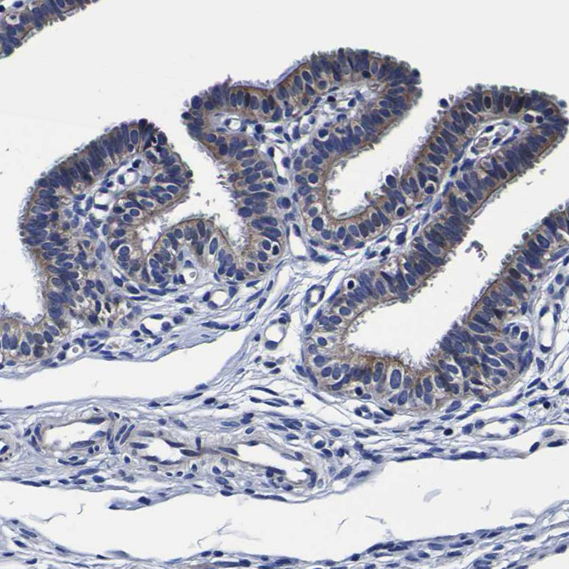 Staining of human Fallopian tube shows weak to moderate membranous and cytoplasmic positivity in glandular cells.