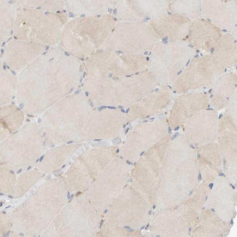 Immunohistochemistry-Paraffin Ribophorin II Antibody - BSA Free