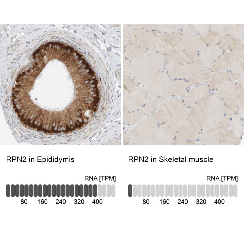 Immunohistochemistry-Paraffin Ribophorin II Antibody - BSA Free
