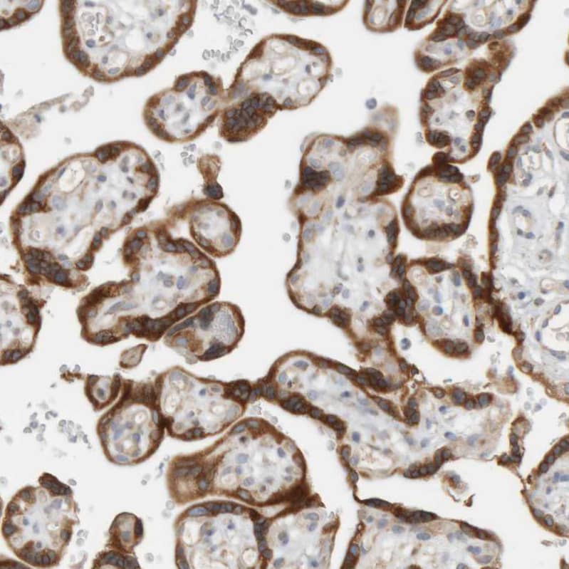 Immunohistochemistry-Paraffin Ribophorin II Antibody - BSA Free